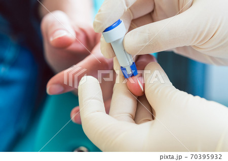 Nurse puncturing finger of patient to squeeze out blood sample for testing Nurse puncturing finger of patient to squeeze out blood sample for testing 70395932
