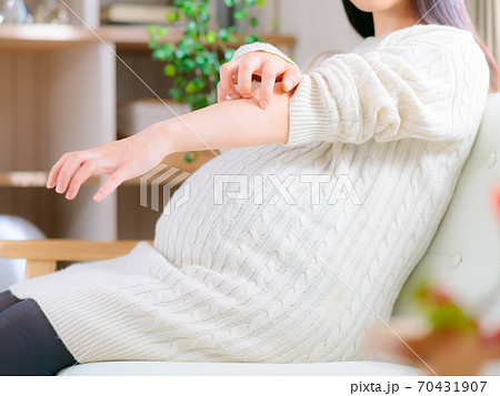 腕を掻く妊婦 4:3 腕を掻く妊婦 4:3 70431907