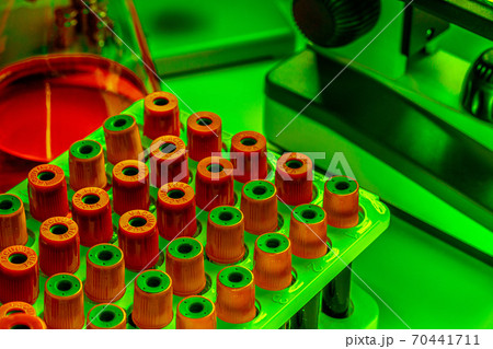Close up photo of microscope with test tubes with blood samples 70441711