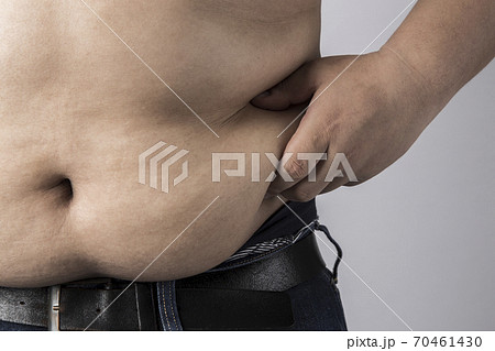 メタボの男性 メタボの男性 70461430