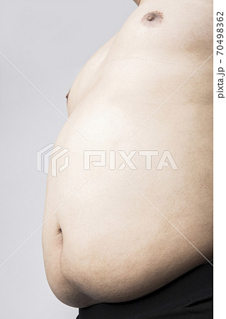 メタボの男性 70498362