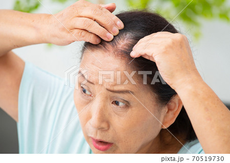 生え際を気にする女性 70519730