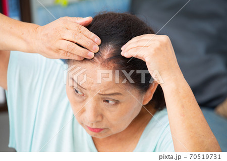 生え際を気にする女性 生え際を気にする女性 70519731