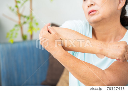 シニア女性　肘の痛み 70527453