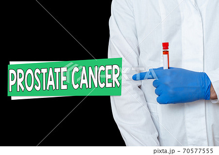 Writing note showing Prostate Cancer. Business 70577555