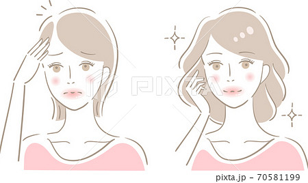 薄毛　女性　ビフォアアフター 70581199