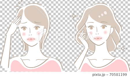 薄毛　女性　ビフォアアフター 70581199