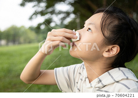 Sick asian child girl using tissue paper for stop bleeding from the nose,female teenage with nosebleed or epistaxis suffer from allergic rhinitis,respiratory or nose injury, bleeding from an accident 70604221