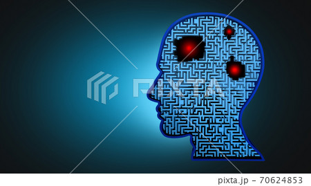 Cancer Of The Brain 70624853