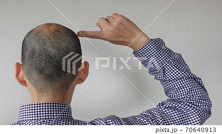 ハゲ坊主の日本人男性が後頭部に指を指すの写真素材