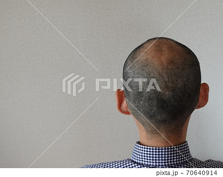 ハゲ坊主の日本人男性の後頭部の写真素材