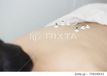 鍼灸イメージ 70648642