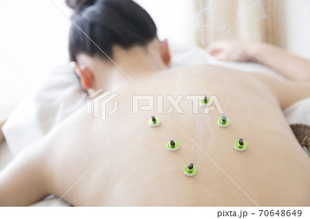 鍼灸イメージ 鍼灸イメージ 70648649