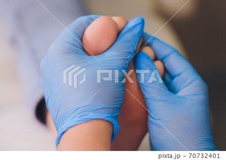 Therapist hands in protective gloves massaging woman's feet. Therapist hands in protective gloves massaging woman's feet. 70732401
