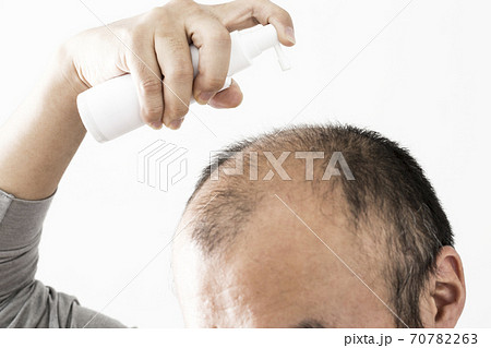育毛スプレーをする男性 育毛スプレーをする男性 70782263