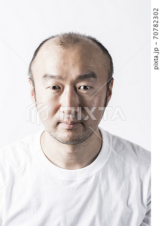 薄毛の男性 70782302