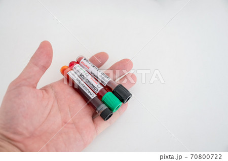 Sample of blood test tubes on chemist palm for diagnosis coronavirus, covid-19 infection in the lab Sample of blood test tubes on chemist palm for diagnosis coronavirus, covid-19 infection in the lab 70800722