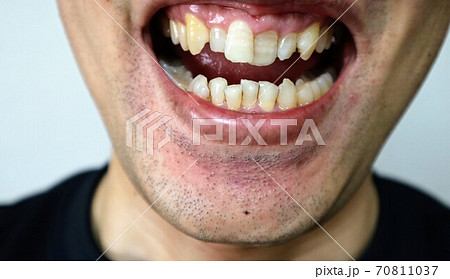 笑顔の日本人男性のクローズアップ 70811037