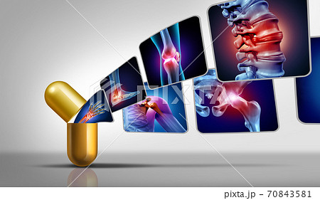 Joint Pain Medicine Joint Pain Medicine 70843581
