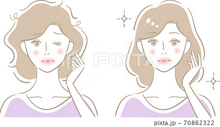 ヘアケア 女性 ビフォアアフター ヘアケア 女性 ビフォアアフター 70862322