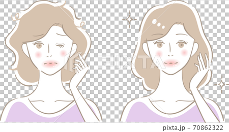 ヘアケア 女性 ビフォアアフター ヘアケア 女性 ビフォアアフター 70862322
