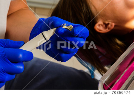 The dentist removes tartar using ultrasound, the patient at the dentist. 70866474