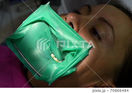 A woman at a dentist's appointment, a dentist uses a rubber dam and dental tools for treatment. A woman at a dentist's appointment, a dentist uses a rubber dam and dental tools for treatment. 70866484