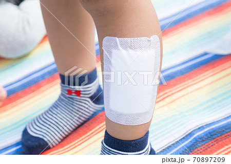 幼児ケガ 幼児ケガ 70897209