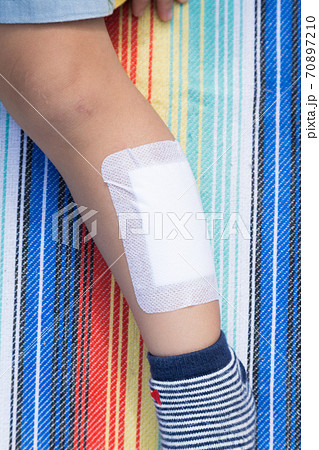 幼児怪我 幼児怪我 70897210