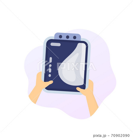 Mammogram in hands, breast scan, vector 70902090
