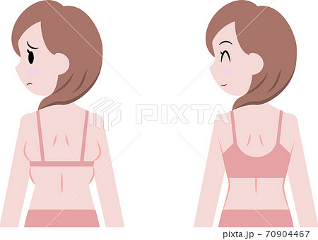 脇の肉がはみ出た女性と補正下着 70904467