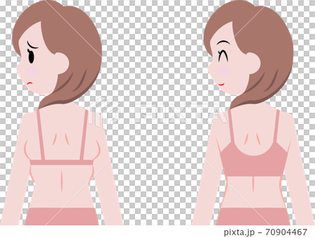 脇の肉がはみ出た女性と補正下着 70904467