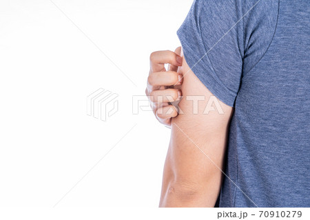 Male scratching his arm isolated white background. Medical, healthcare for advertising concept. 70910279