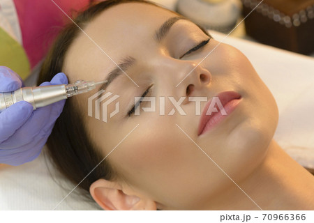 Woman Getting Laser Tattoo Procedure Woman Getting Laser Tattoo Procedure 70966366