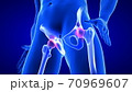 Hip Pain close-up illustration. Blue Human Anatomy Body 3D Scan render on blue background 70969607