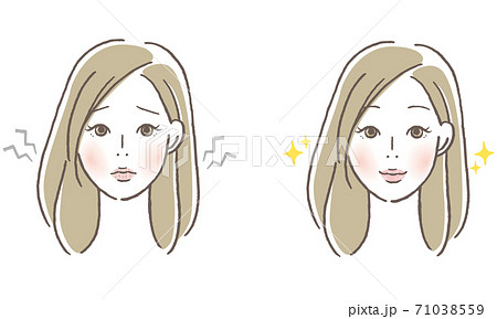 ガサガサの唇とつやつやの唇の女性 ガサガサの唇とつやつやの唇の女性 71038559