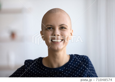 Head shot portrait smiling hairless woman looking at camera 71048574