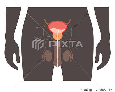 BPH info concept BPH info concept 71085147