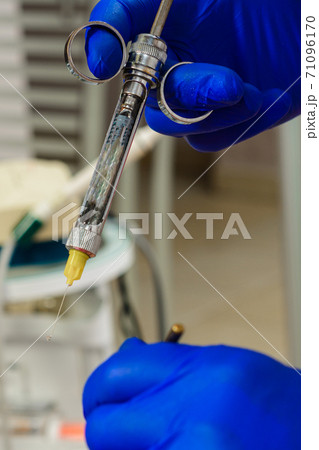 The dentist with the help of a carpule syringe injects anesthesia into the patient's gums, local anesthesia. The dentist with the help of a carpule syringe injects anesthesia into the patient's gums, local anesthesia. 71096170