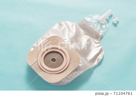 ストーマ（人工肛門）装具 71104761