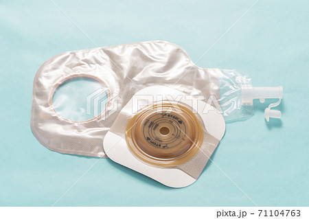 ストーマ（人工肛門）装具 71104763