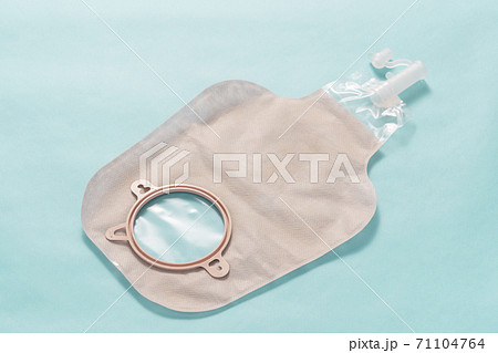 ストーマ（人工肛門）装具 71104764