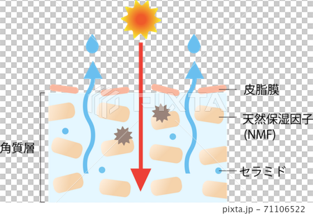 乾燥肌　セラミド　断面図 71106522