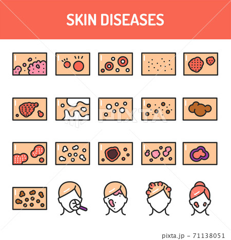 Skin diseases color line icons set. Isolated vector element. Outline pictograms for web page, mobile app, promo Skin diseases color line icons set. Isolated vector element. Outline pictograms for web page, mobile app, promo 71138051