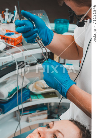 Installation of a rubber dam with a metal clamp for dental fillings, sterile and modern dental treatment. Installation of a rubber dam with a metal clamp for dental fillings, sterile and modern dental treatment. 71151846