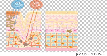 Ultraviolet (UVA / UVB) skin damage diagram 71174570