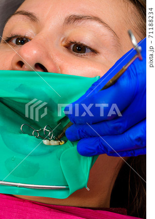 The dentist treats the patient's tooth with a rubber dam, drill, mirror. The dentist treats the patient's tooth with a rubber dam, drill, mirror. 71188234