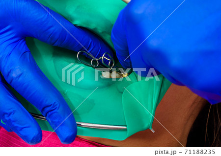 The dentist treats the patient's tooth with a rubber dam, drill, mirror. 71188235