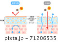 乾燥肌　ビフォアアフター 71206535