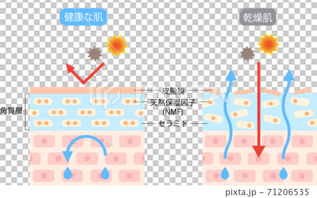 乾燥肌　ビフォアアフター 71206535